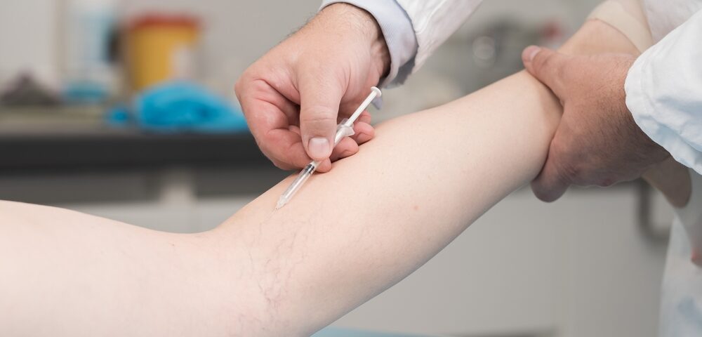 sclerotherapy in Havre de Grace MD