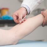 sclerotherapy in Havre de Grace MD
