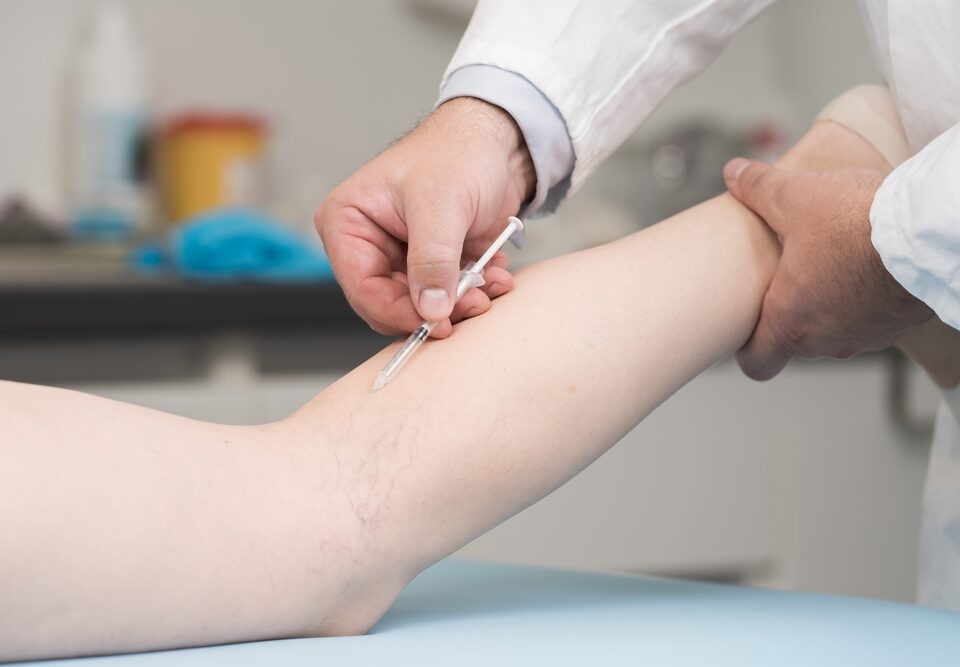 sclerotherapy in Havre de Grace MD