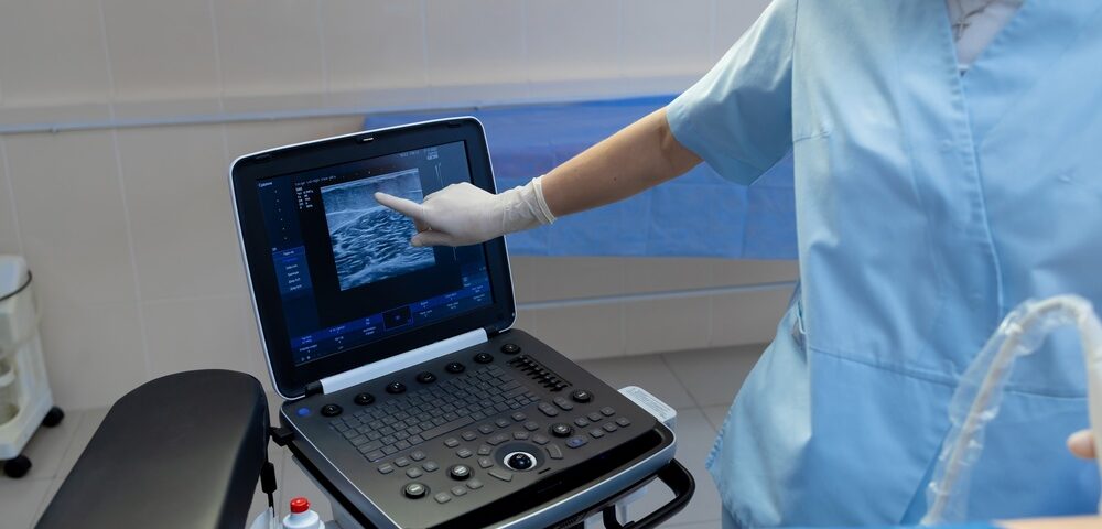 vein doctor near Bel Air MD