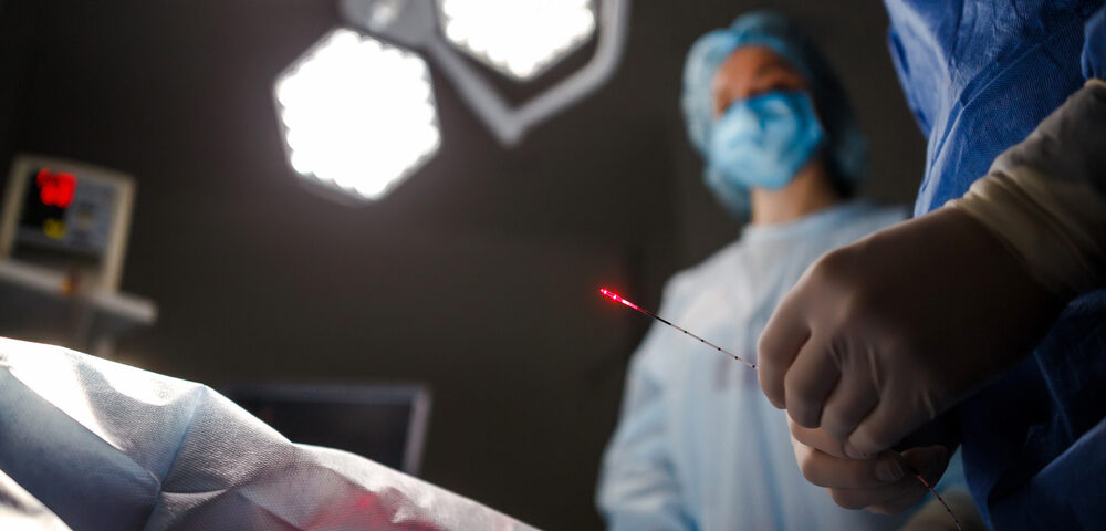 EVLT procedure in Maryland