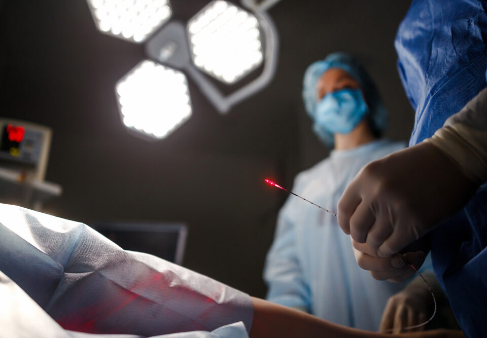 EVLT procedure in Maryland
